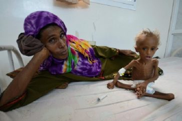 yemen_famine