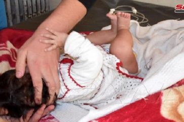 Un bébé blessé par l'agression israélienne contre Hama