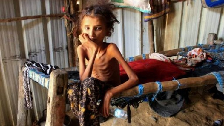 famine_yemen