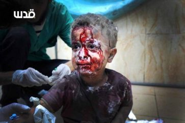 Cet enfant est l’un des rescapés des 44 massacres israéliens perpétrés contre la bande de Gaza