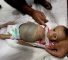 La petite Zainab Abu Hulaib a succombé à une faim impitoyable avant de fêter son premier anniversaire. Zainab s'est éteinte en silence, témoin, une fois de plus, du crime israélien qui ravage les enfants de Gaza.